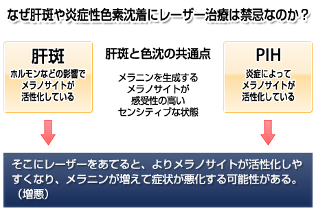 なぜ肝斑や炎症性色素沈着にレーザー治療は禁忌なのか