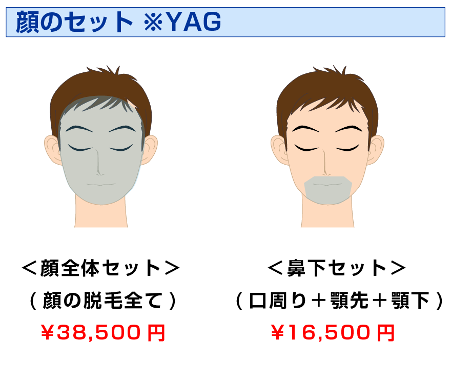 男性レーザー脱毛 基本セット