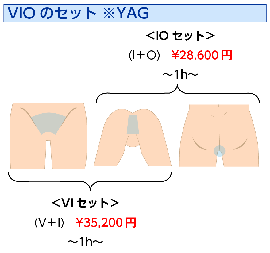 男性レーザー脱毛 VI・IO