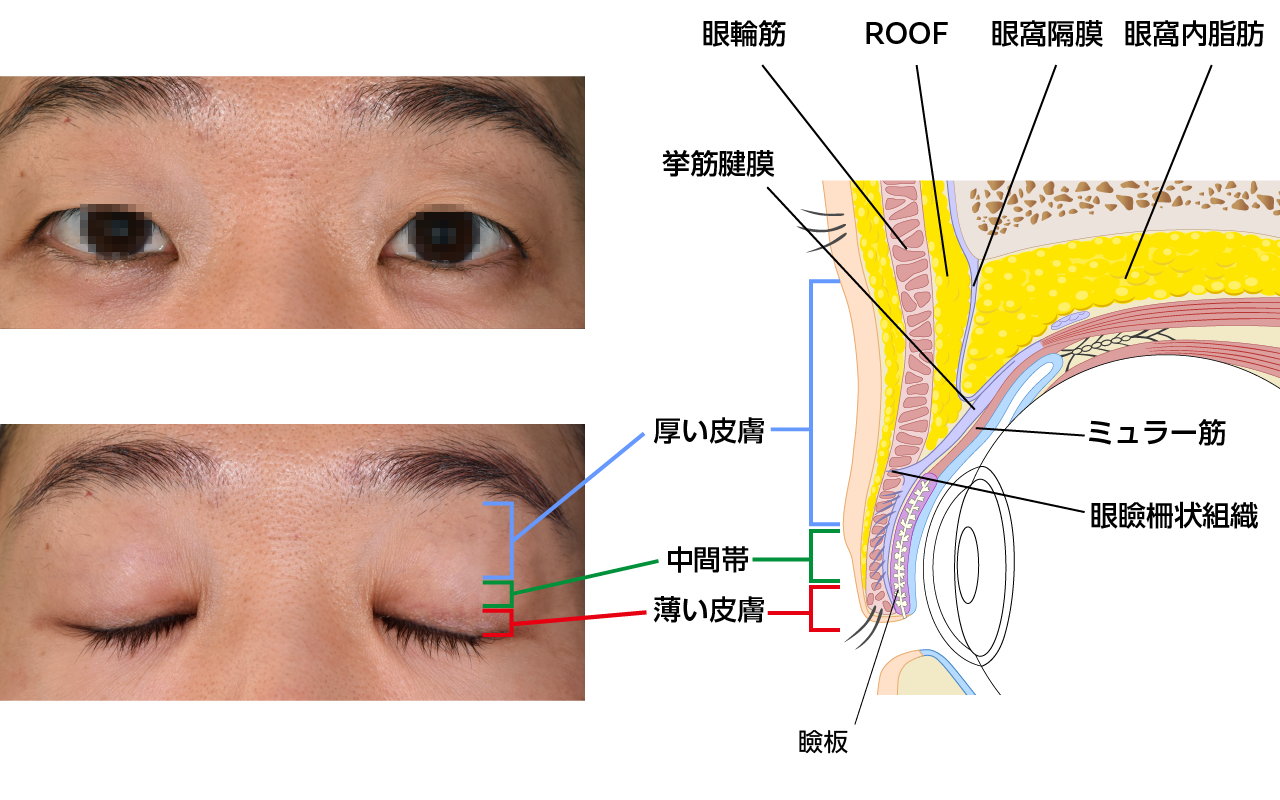 上まぶたの構造