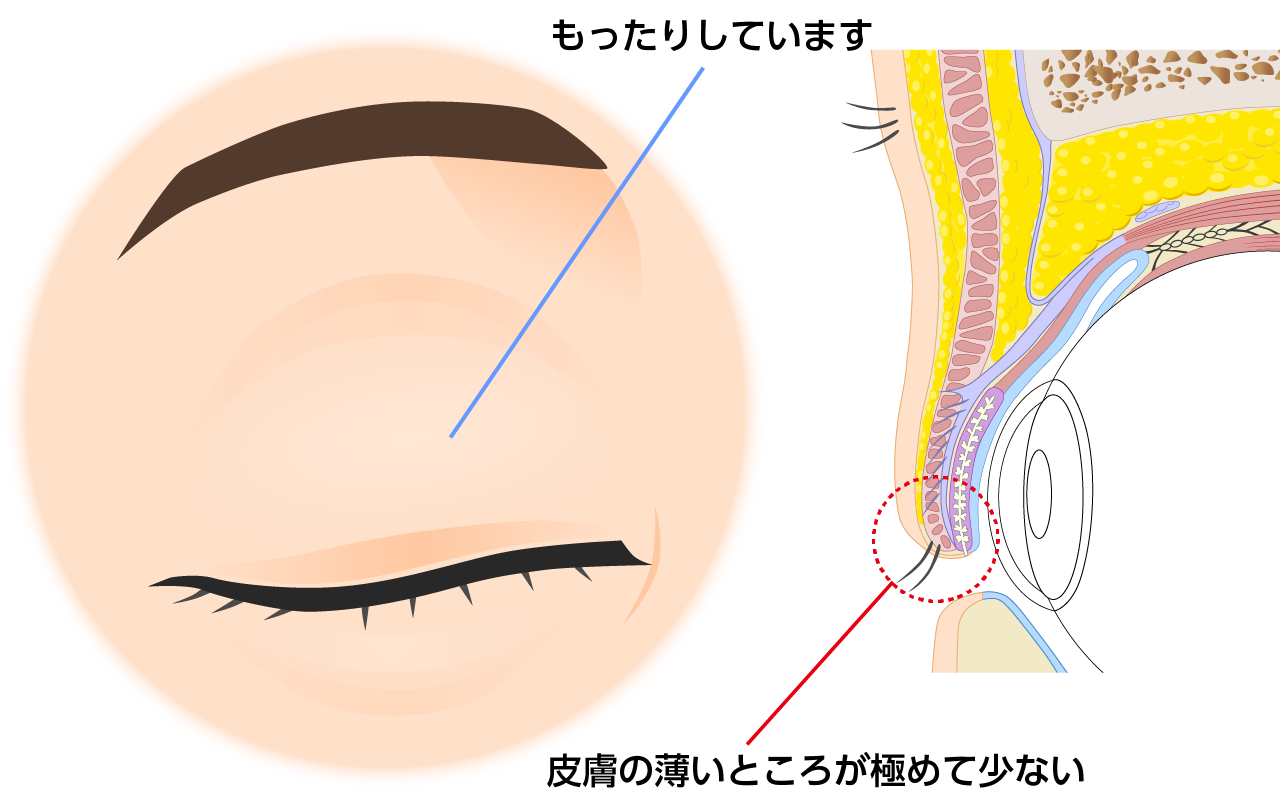 上眼瞼が厚ぼったい人
