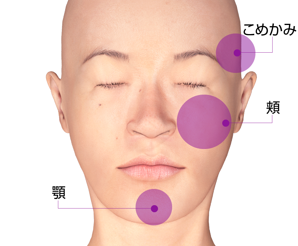 ヒアルロン酸の注入位置